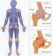 My Arthritis Pain Bye Bye™ - The Best Solution for Your Arthritis Pain